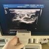 PHILIPS Used  IU22 Convex Linear Linear 3 Probes Ultrasound Unit