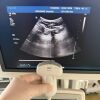 PHILIPS Used  IU22 Convex Linear Linear 3 Probes Ultrasound Unit