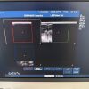 PHILIPS Used  IU22 Convex Linear Linear 3 Probes Ultrasound Unit