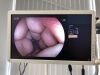 FUJIFILM EC-760P-V/M Colonoscope