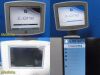 Zonare Medical Zone Scan Engine W/ Smart Mini Cart & Sony UP-897 Printer