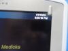 Zonare Medical Zone Scan Engine W/ Smart Mini Cart & Sony UP-897 Printer