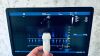 GE GENERAL ELECTRIC Ge Vivid E95 v.202 with M5Sc-D Ultrasound - Cardiac - Vascular
