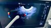 GE Logiq S8 E8 R.4 General use ultrasound