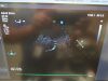 PHILIPS X7-2T Compact Endoscope