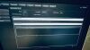 PHILIPS Epiq Elite 7G Hw. B.1 Nov 2019 Philips Epiq 7G