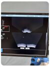 NOMOS SONALIS ULTRASOUND IMAGING SYSTEM
