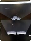 NOMOS SONALIS ULTRASOUND IMAGING SYSTEM
