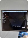 NOMOS SONALIS ULTRASOUND IMAGING SYSTEM