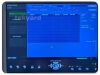 GE Voluson P8 Ultrasound - OB / GYN