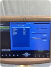 GE Voluson P8 Ultrasound - OB / GYN