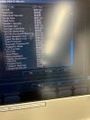 PHILIPS Cx50 Ultrasound - Shared Service