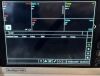 PHILIPS MEDICAL VS4 SURESIGNS Vital Signs Patient Monitor BP Monitor
