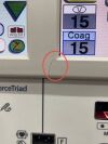COVIDIEN/VALLEYLAB Force Triad SW: 3.60.03, YOM: 2013 Electrosurgical Unit