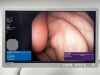 OLYMPUS Scope Model: PCF-H190DL Colonoscope