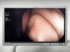 OLYMPUS Scope Model: PCF-H190DL Colonoscope