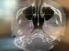 PLANMECA CBCT ProMax 3D Mid Dental Digital Imaging