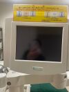 KARL STORZ Modulith SLK Lithotripter Mobile
