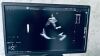 GE Logiq E10 R3 YOM: 2022 with 4 probes General Ultrasound