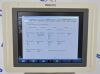 PHILIPS HD11 XE Imaging System W/  L12-5 &amp; S3-1 Handpieces - 209565 Monitor