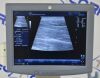GE Logiq P5 Ultrasound System 5266264 W/  10L Linear Array Transducer Probe 2302650 - 209589 Monitor