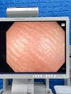 OLYMPUS CV-290 CLV-290 Complete Towers Endoscopy Processor