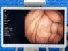 OLYMPUS CV-290 CLV-290 Complete Towers Endoscopy Processor