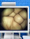 OLYMPUS CV-290 CLV-290 Complete Towers Endoscopy Processor