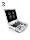 SAMSUNG-MEDISON MySono U6 ultrasound system