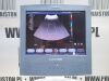 SIEMENS ACUSON X300 ultrasound device
