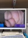 OLYMPUS GF-UCT180 Gastroscope
