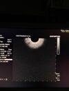 OLYMPUS GF-UCT180 Gastroscope