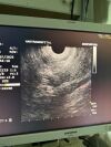 OLYMPUS GF-UCT180 Gastroscope