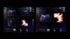 GE VOLUSON E10 Ultrasound - OB / GYN