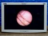 KARL STORZ Scope Model: 11272C1 Cystoscope Lot: 177 Laparoscope