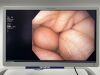 OLYMPUS Scope Model: GIF-H190N Video Gastroscope