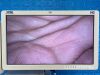 KARL STORZ H3-ZI TH101 Laparoscope