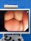 OLYMPUS Scope Model: GIF -HQ290 Endoscope