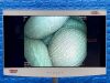PENTAX Scope Model: ECY-1575K YOM: 2020, 23 Times Used. Colonoscope