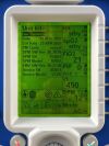 ZOLL 731 Series Ventilator YOM: 2019 -4 pieces Ventilator