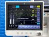 GE DATEX-OHMEDA Carestation 650 YOM: 2016 Anesthesia Machine
