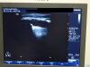 PHILIPS Hd7 Xe Ultrasound - Shared Service