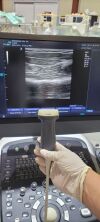 ALPINION L3-12H Probes Ultrasound Transducer