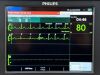 PHILIPS HeartStart Intrepid Defibrillator with Pacer, ECG and CO2 option YOM: 2019 Defibrillator