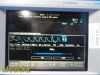 PHILIPS M1020A SpO2 Plethysmography Module