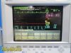 PHILIPS /Agilent VARIDIA 24C/26, W/ M1041A Rack+7 Modules~ Anesthesia Monitor