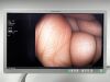 OLYMPUS PCF-H190DL Colonoscope