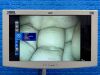 KARL STORZ 13925 PKS Colonoscope