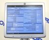 GE HEALTHCARE Logiq S8 Ultrasound Machine 2014 w/GE ML6-15-D Wideband Matrix Linear Array Probe - 221493 Monitor