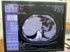 GE Optima 660 CT Scanner
